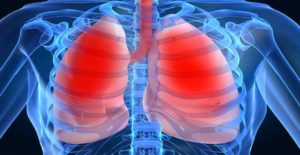 Hipertension-pulmonar-causas