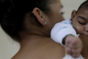zika microcefalia