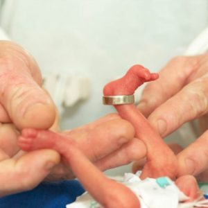 bebes-prematuros
