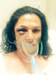 ana-guevara-golpeada