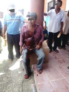 lesionado